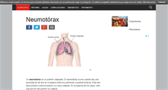 Desktop Screenshot of neumotorax.org