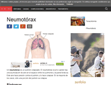 Tablet Screenshot of neumotorax.org